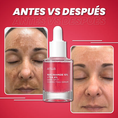 serum anua- control manchas